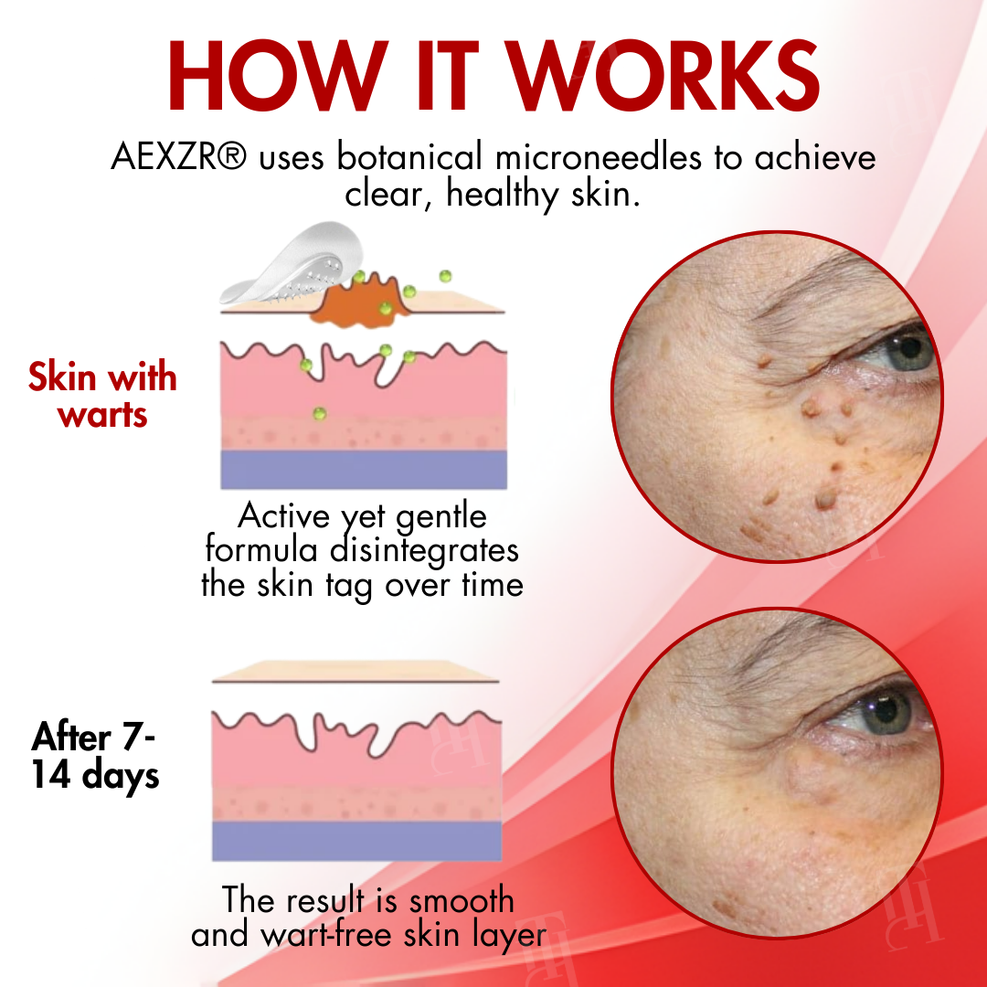 AEXZR® Nano-Microdart Skin Tag & Spot Corrector Patches