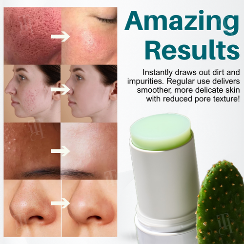AEXZR® CACTIGLOW Multi-Action Pore Refining Balm